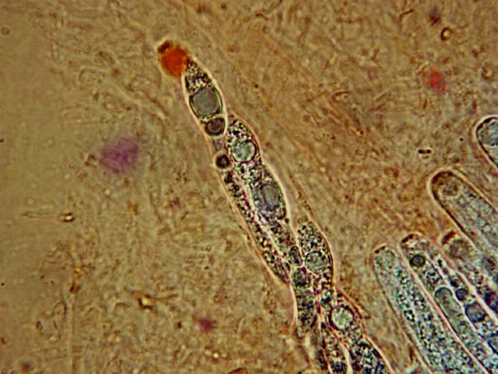 macrostoma