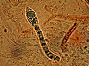 macrostoma