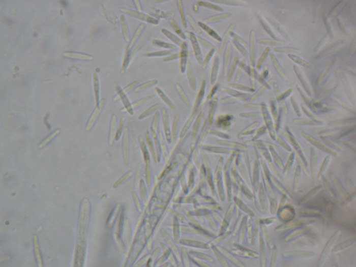 macrostoma
