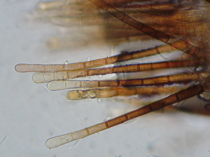 macrostoma