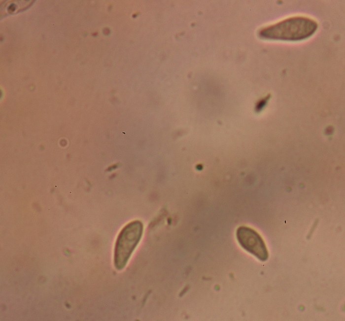 macrostoma