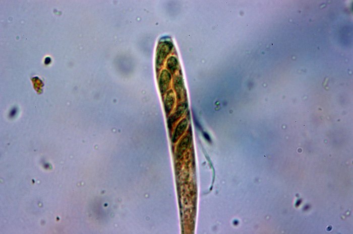 macrostoma