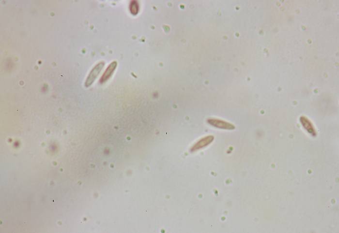 macrostoma
