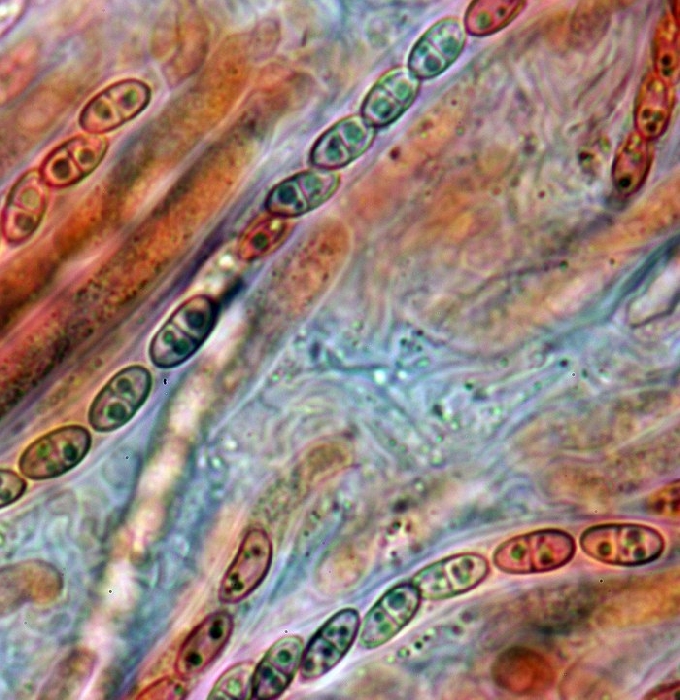 macrostoma