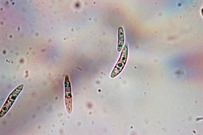 macrostoma