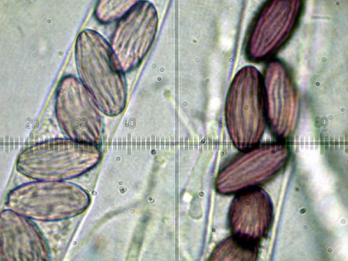 macrostoma