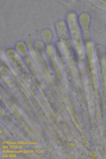 macrostoma