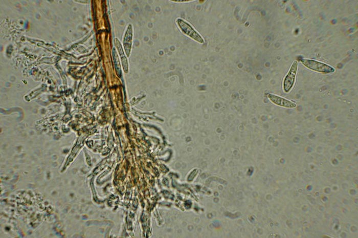 macrostoma