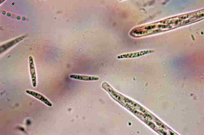 macrostoma