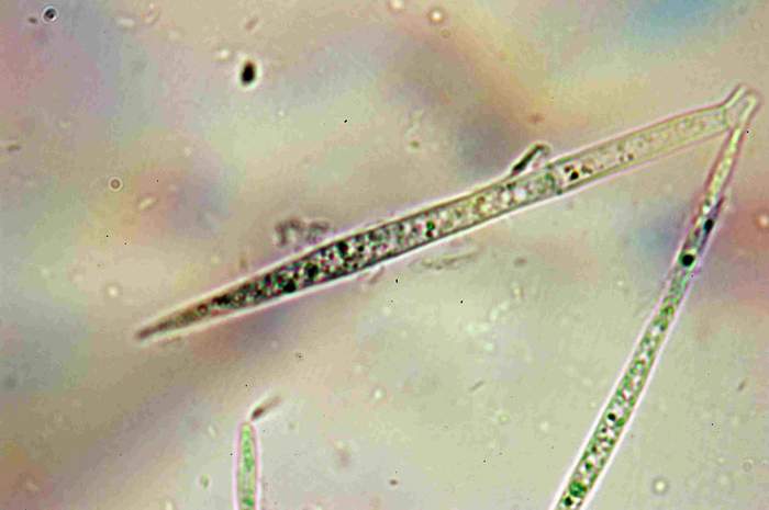 macrostoma