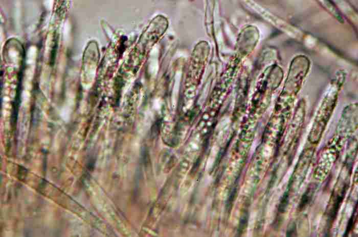 macrostoma