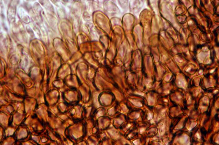 macrostoma