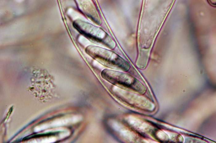 macrostoma