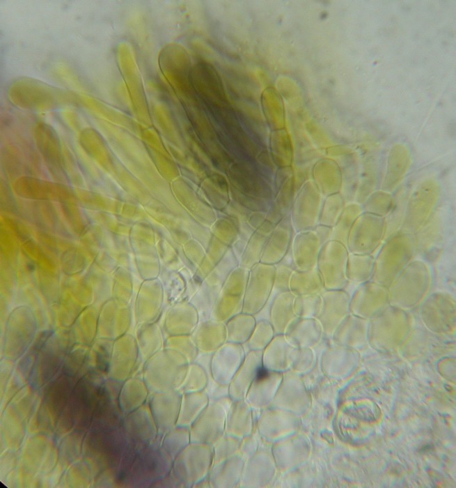 macrostoma