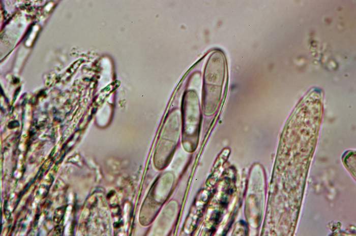 macrostoma