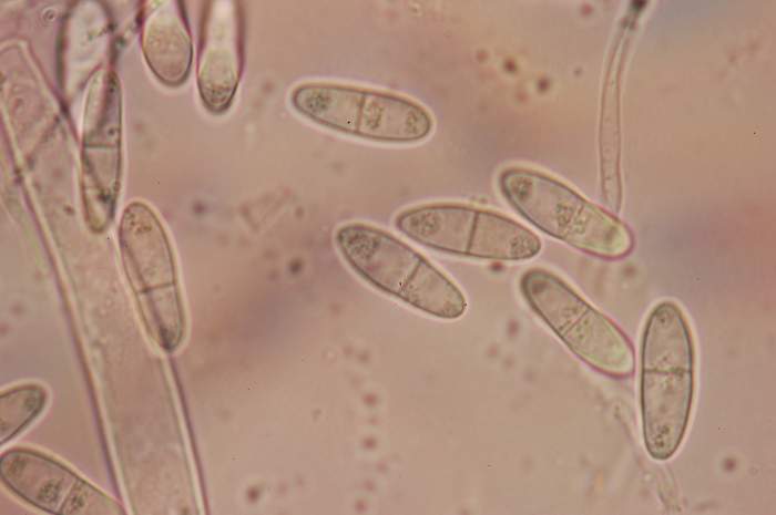 macrostoma