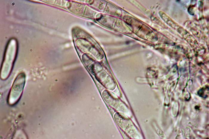 macrostoma