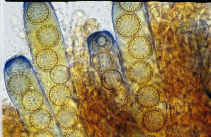 macrostoma