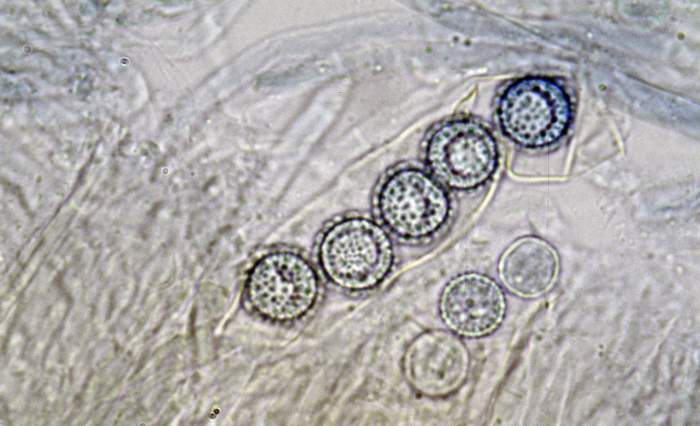 macrostoma