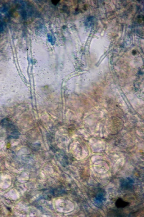 macrostoma