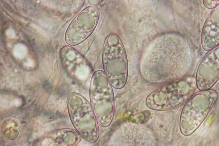 macrostoma