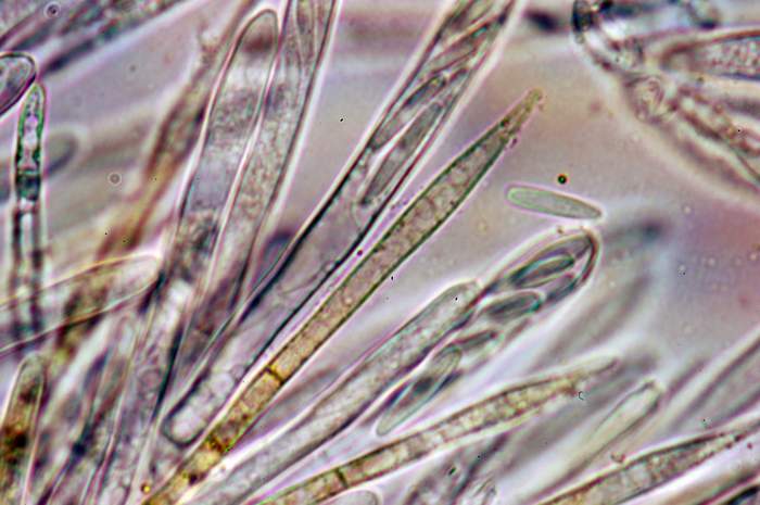 macrostoma