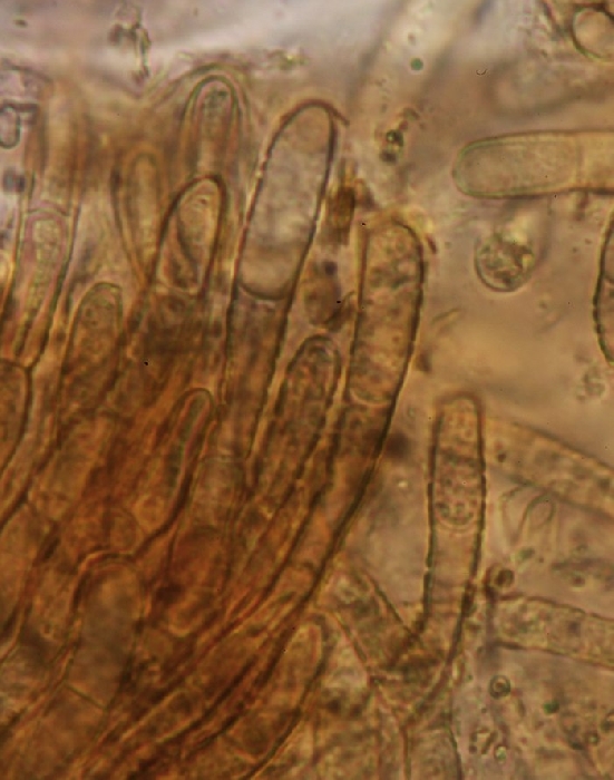 macrostoma