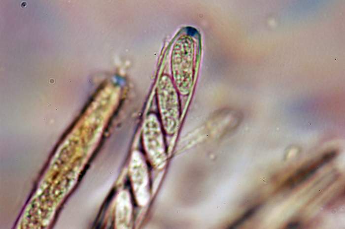 macrostoma