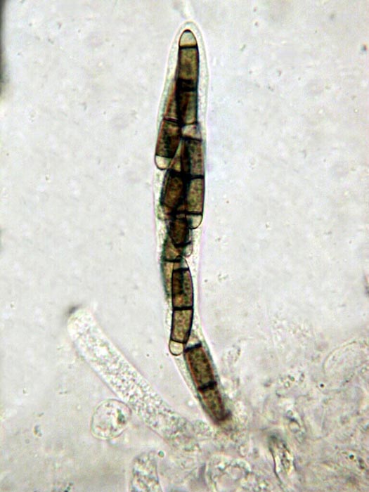macrostoma