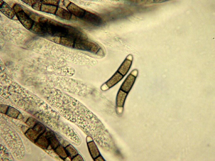 macrostoma