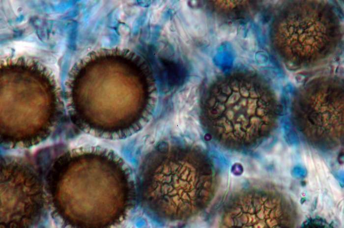 macrostoma