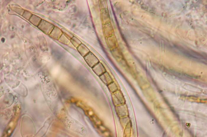 macrostoma