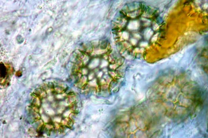 macrostoma