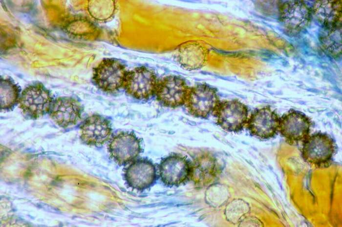 macrostoma