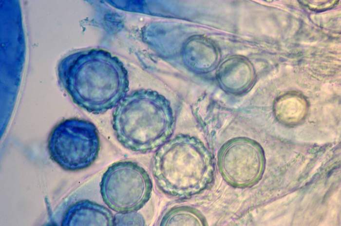 macrostoma