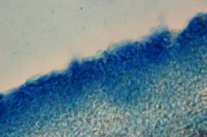 macrostoma