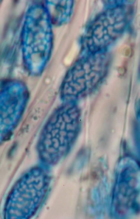macrostoma