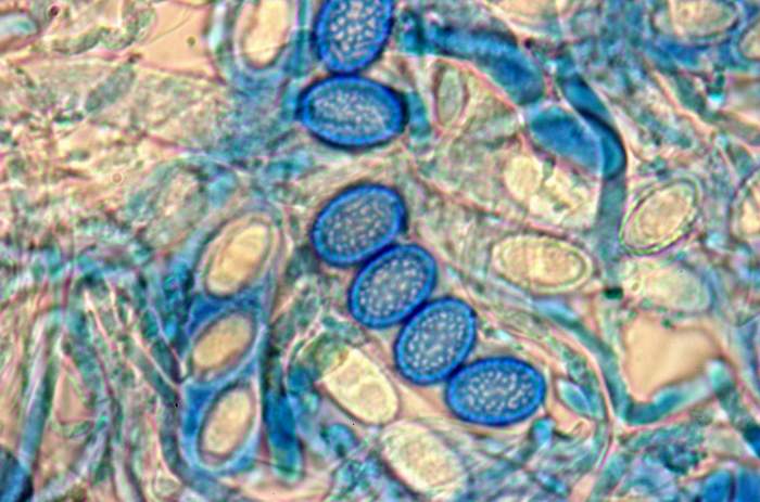macrostoma