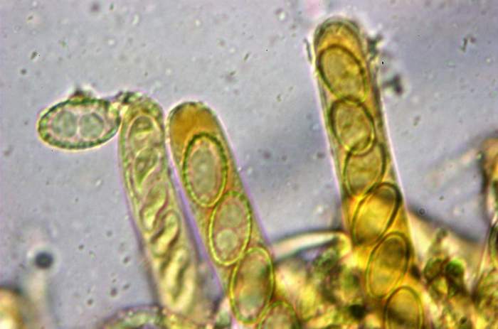 macrostoma