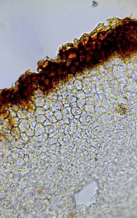 macrostoma