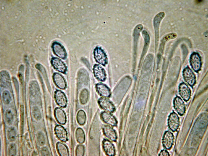 macrostoma