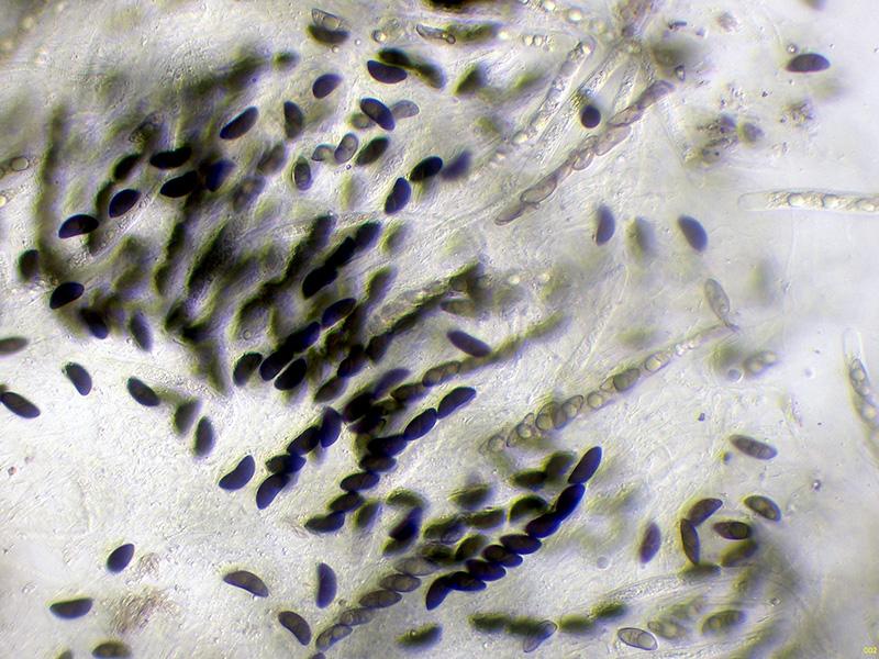 macrostoma
