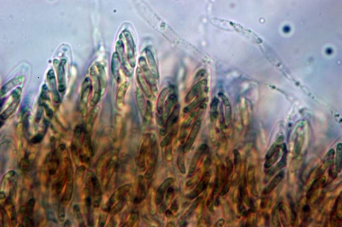 macrostoma