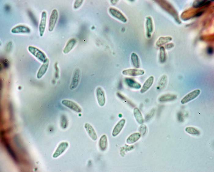 macrostoma