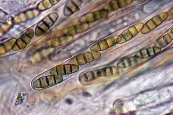 macrostoma