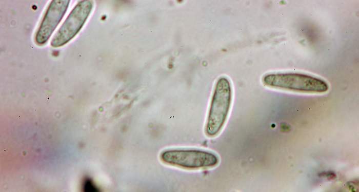 macrostoma