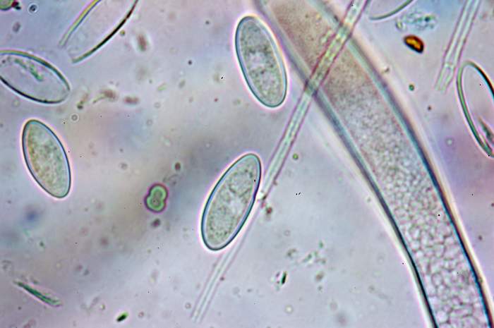 macrostoma