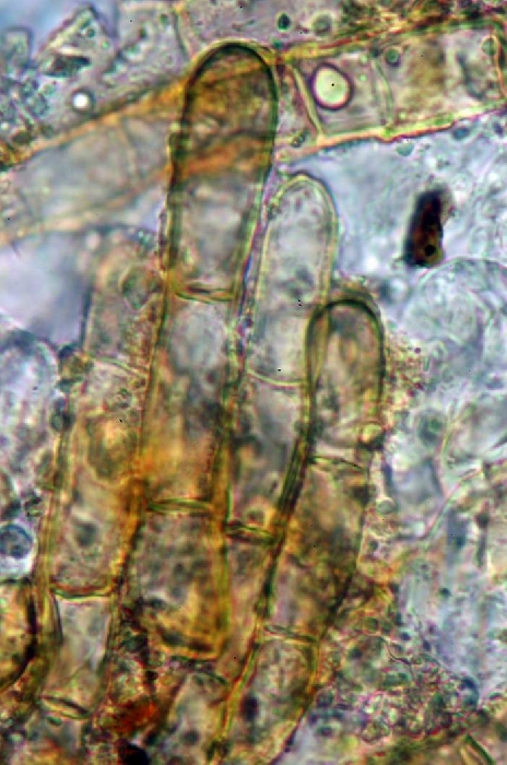 macrostoma