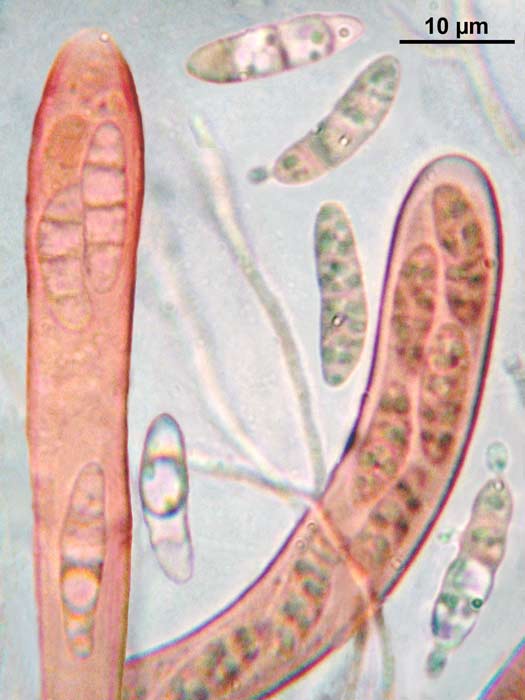 macrostoma