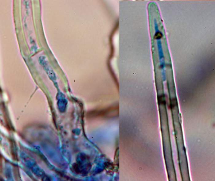 macrostoma